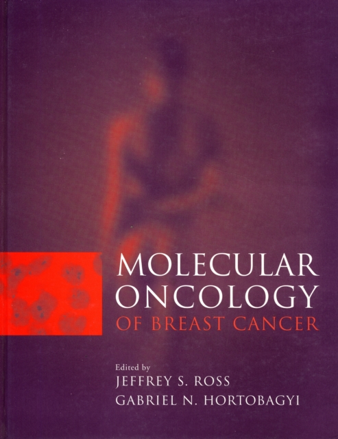 Molecular Oncology of Breast Cancer, Hardback Book