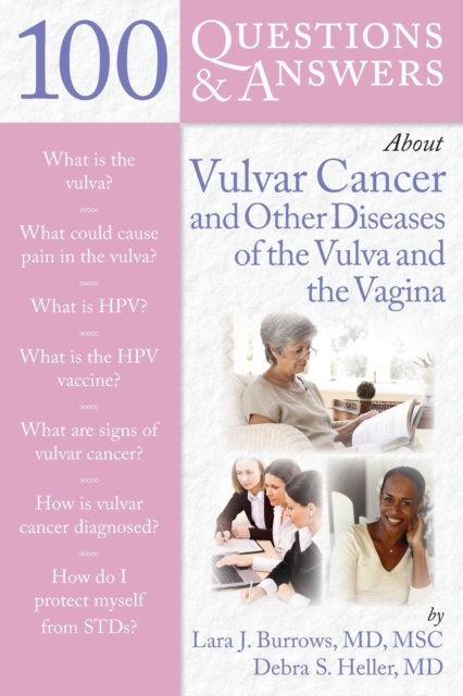 100 Questions  &  Answers About Vulvar Cancer And Other Diseases Of The Vulva And Vagina, Paperback / softback Book