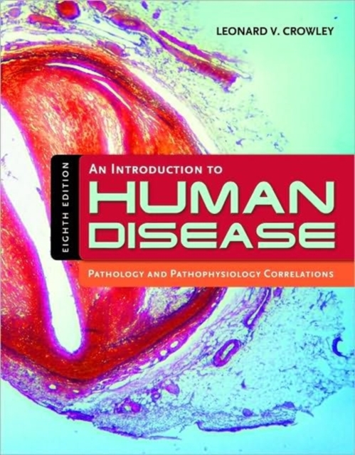 An Introduction to Human Disease: Pathology and Pathophysiology Correlations, Hardback Book