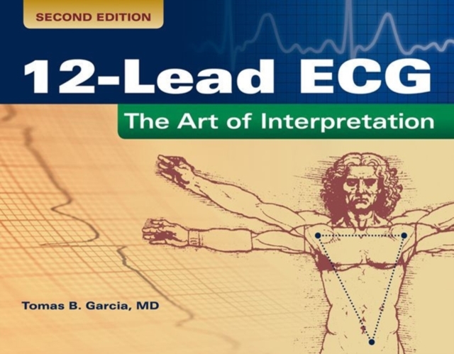 12-Lead ECG: The Art Of Interpretation, Paperback / softback Book