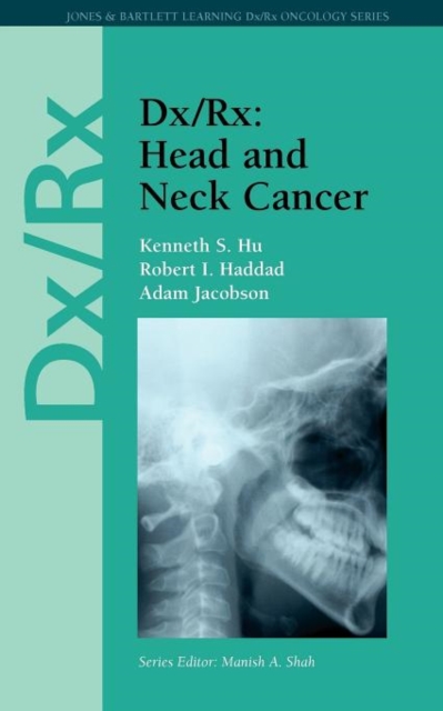 Dx/Rx: Head and Neck Cancer : Head and Neck Cancer, Paperback / softback Book
