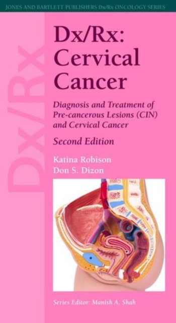 Dx/Rx: Cervical Cancer 2e, Paperback / softback Book