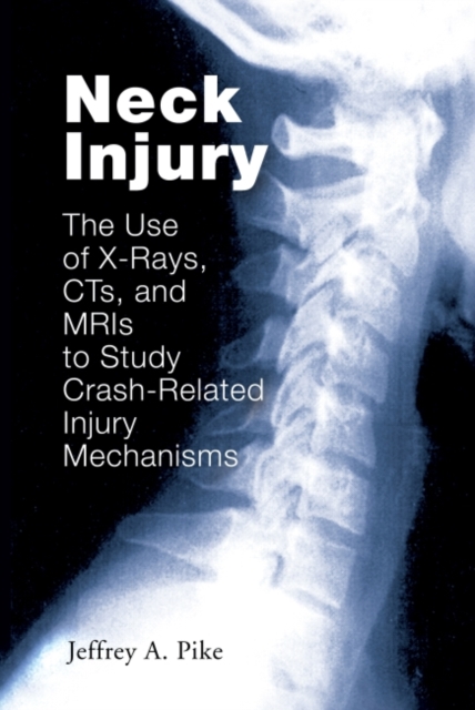 Neck Injury : The Use of X-Rays, CTs, and MRIs to Study Crash-Related Injury Mechanisms, Hardback Book
