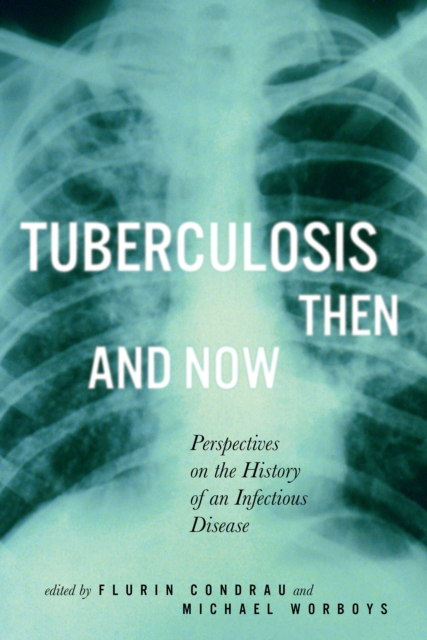 Tuberculosis Then and Now : Perspectives on the History of an Infectious Disease Volume 37, Hardback Book