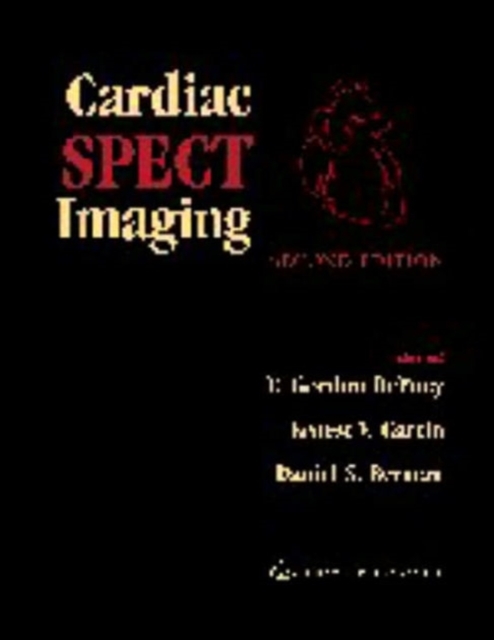 Cardiac SPECT Imaging, Hardback Book
