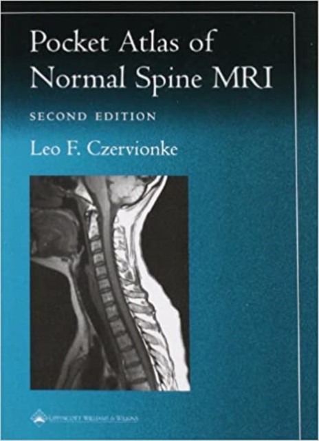 Pocket Atlas of Spinal MRI, Paperback / softback Book
