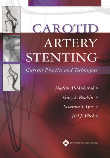 Carotid Artery Stenting : Current Practice and Techniques, Hardback Book