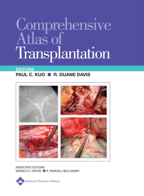 Comprehensive Atlas of Transplantation, Hardback Book