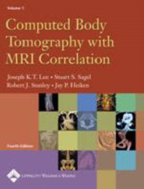 Computed Body Tomography with MRI Correlation, Hardback Book