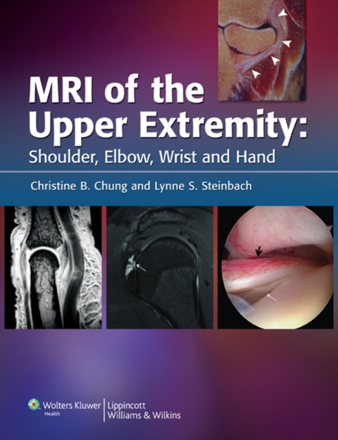 MRI of the Upper Extremity : Shoulder, Elbow, Wrist and Hand, Hardback Book