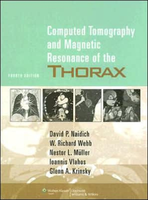 Computed Tomography and Magnetic Resonance of the Thorax, Hardback Book