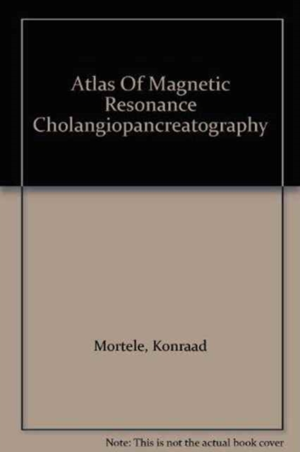 Atlas of Magnetic Resonance Cholangiopancreatography, Hardback Book