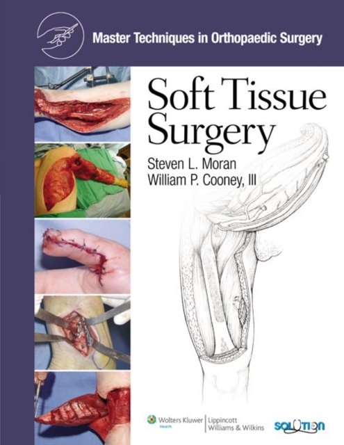 Master Techniques in Orthopaedic Surgery: Soft Tissue Surgery, Hardback Book