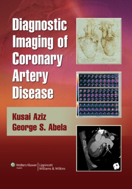 Diagnostic Imaging of Coronary Artery Disease, Hardback Book