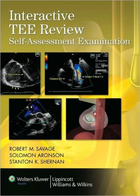 Interactive TEE Review DVD : Self-Assessment Examination DVD NTSC format, DVD-ROM Book