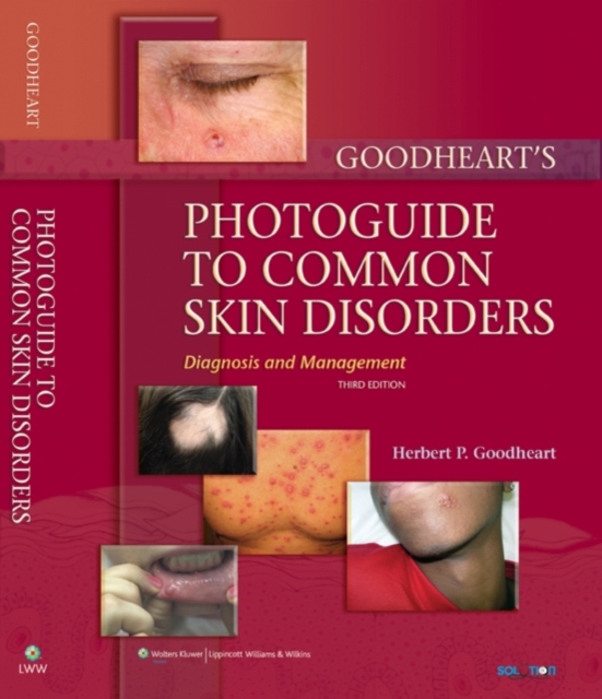 Goodheart's Photoguide to Common Skin Disorders : Diagnosis and Management, Hardback Book