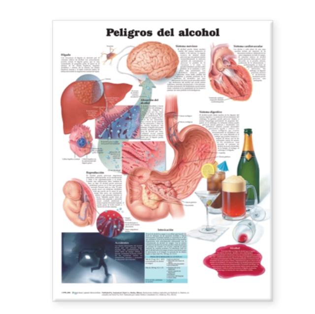 Dangers of Alcohol Anatomical Chart in Spanish (Peligros del alcohol), Wallchart Book