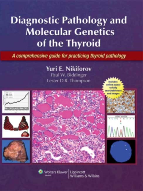 Diagnostic Pathology and Molecular Genetics of the Thyroid : A Comprehensive Guide for Practicing Thyroid Pathology, Hardback Book