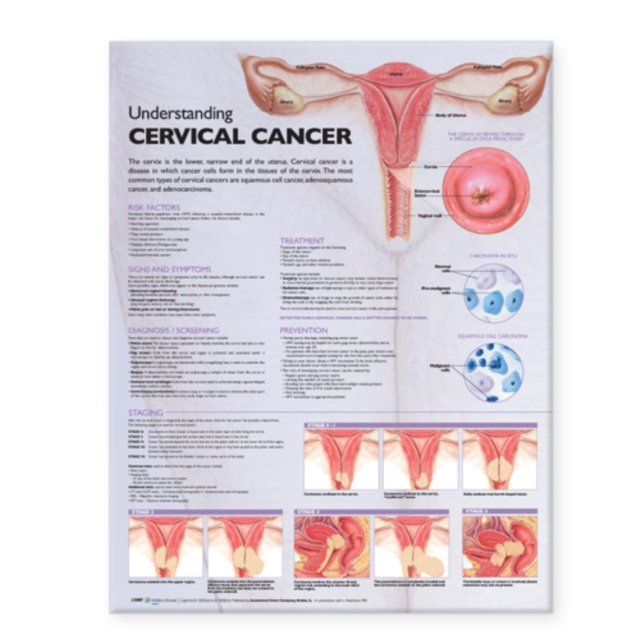 Understanding Cervical Cancer Anatomical Chart, Wallchart Book