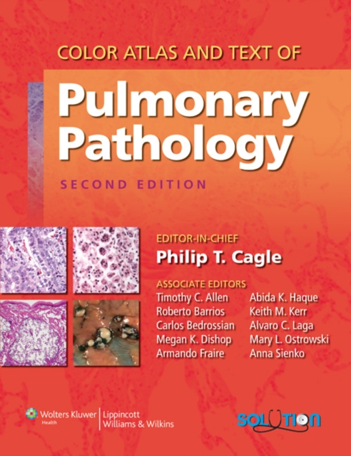 Color Atlas and Text of Pulmonary Pathology, Hardback Book