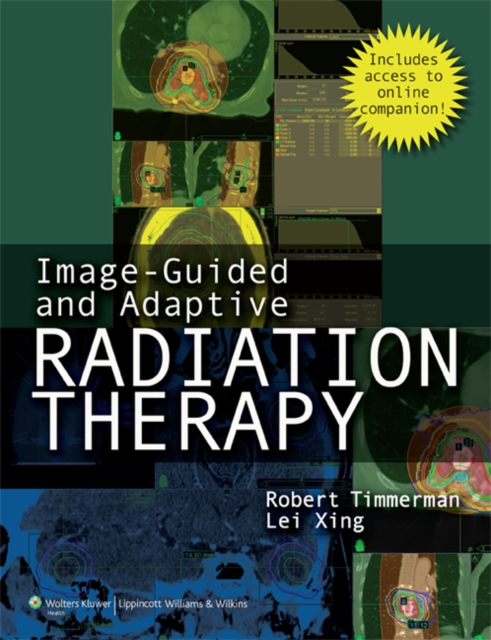 Image-Guided and Adaptive Radiation Therapy, Hardback Book