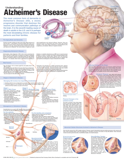 Understanding Alzheimer's Disease Anatomical Chart, Wallchart Book