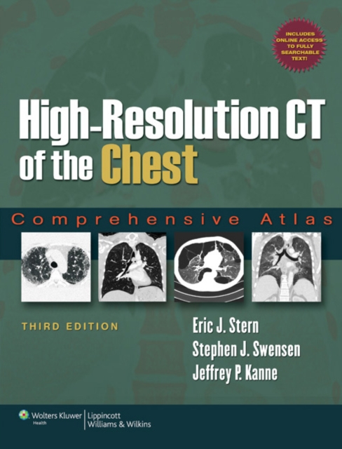 High-Resolution CT of the Chest : Comprehensive Atlas, Hardback Book