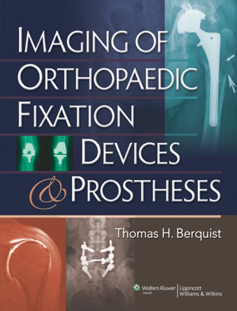 Imaging of Orthopaedic Fixation Devices and Prostheses, Hardback Book