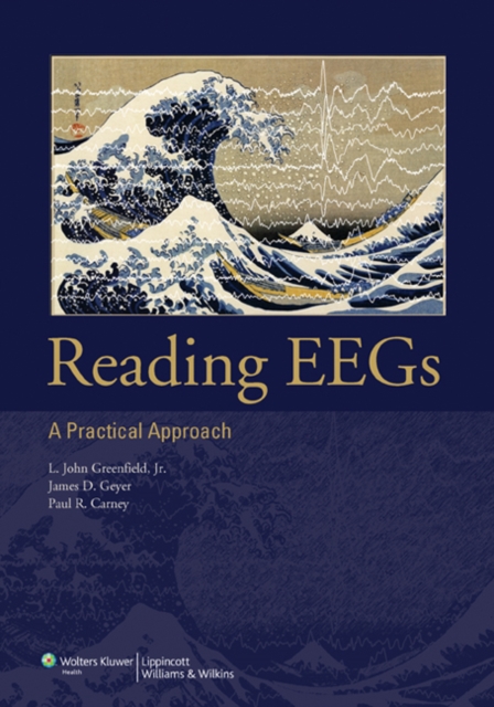 Reading EEGs: A Practical Approach, Paperback / softback Book