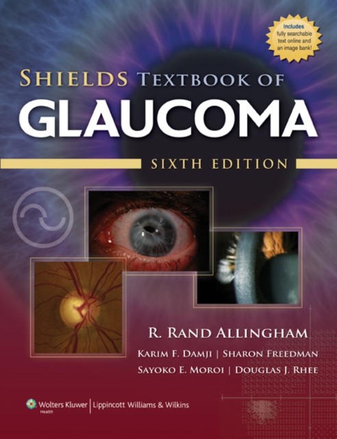 Shields Textbook of Glaucoma, Hardback Book
