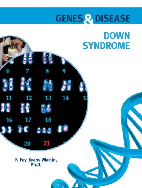 Down Syndrome, Hardback Book