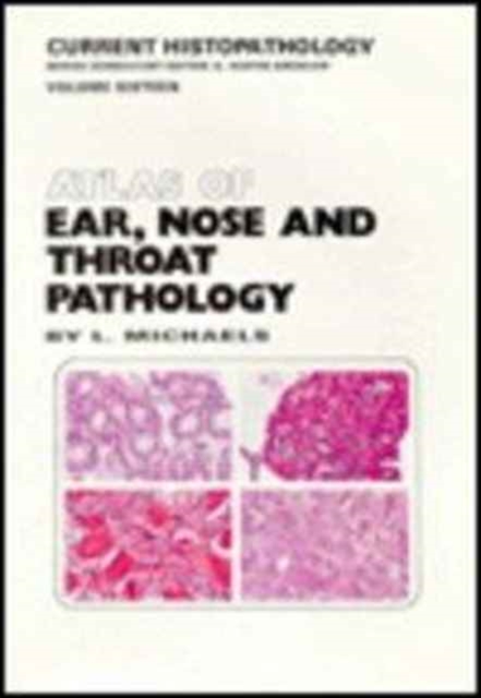 Atlas of Ear, Nose and Throat Pathology, Hardback Book