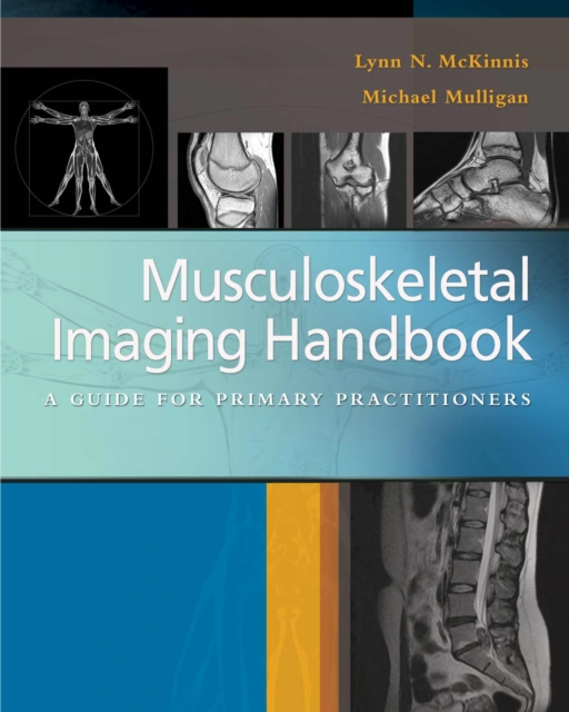 Musculoskeletal Imaging Handbook : a Guide for Primary Practitioners, Paperback / softback Book