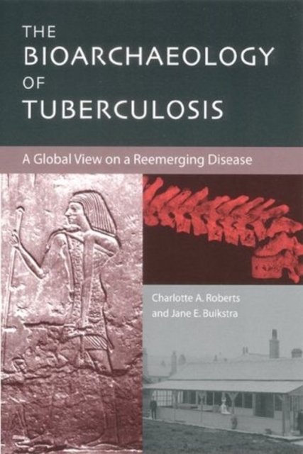 The Bioarchaeology of Tuberculosis : A Global View on a Reemerging Disease, Paperback / softback Book