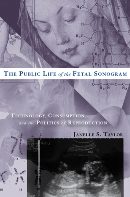 The Public Life of the Fetal Sonogram : Technology, Consumption, and the Politics of Reproduction, Paperback / softback Book