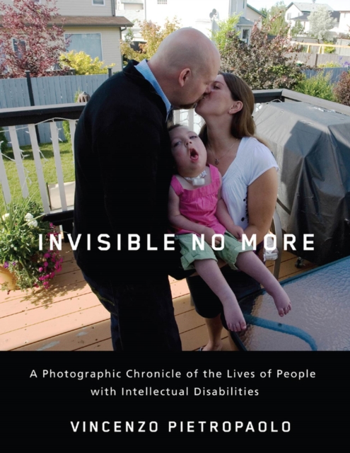 Invisible No More : A Photographic Chronicle of the Lives of People with Intellectual Disabilities, Hardback Book