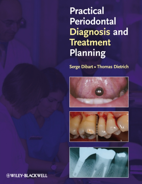 Practical Periodontal Diagnosis and Treatment Planning, PDF eBook