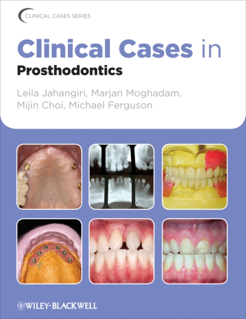 Clinical Cases in Prosthodontics, Paperback / softback Book