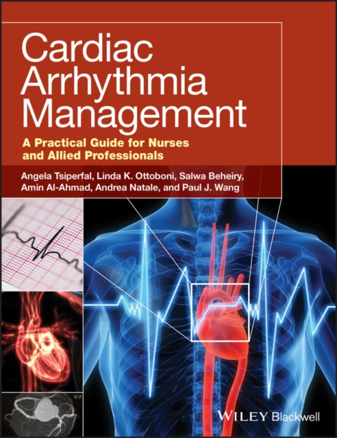 Cardiac Arrhythmia Management : A Practical Guide for Nurses and Allied Professionals, Paperback / softback Book