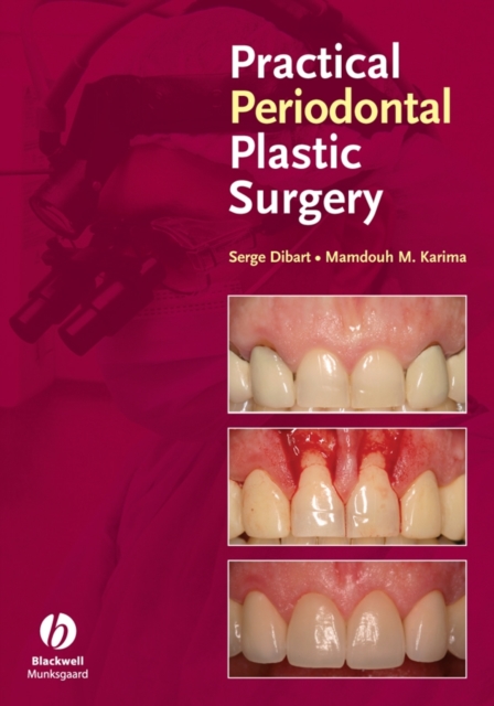 Practical Periodontal Plastic Surgery, Hardback Book