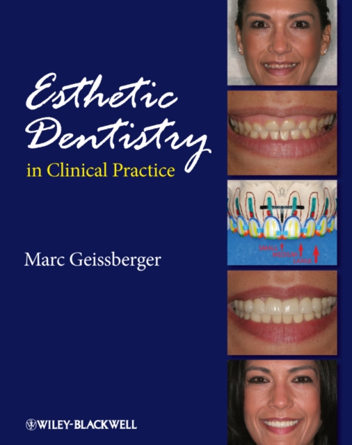 Esthetic Dentistry in Clinical Practice, Hardback Book
