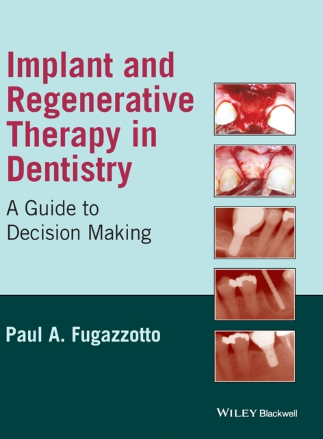 Implant and Regenerative Therapy in Dentistry : A Guide to Decision Making, Hardback Book