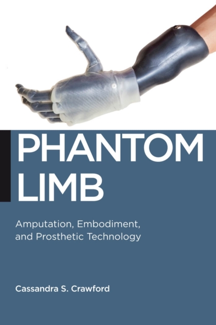 Phantom Limb : Amputation, Embodiment, and Prosthetic Technology, EPUB eBook