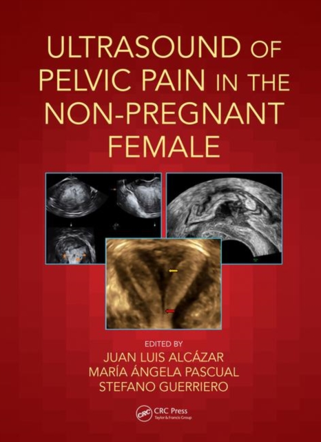 Ultrasound of Pelvic Pain in the Non-Pregnant Patient, Paperback / softback Book