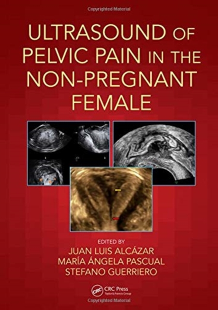 Ultrasound of Pelvic Pain in the Non-Pregnant Patient, Hardback Book