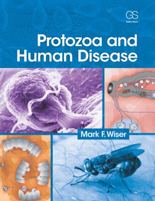 Protozoa and Human Disease, Paperback / softback Book
