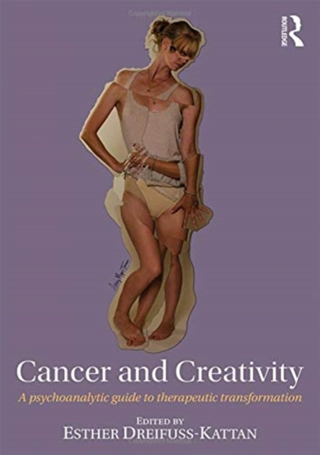 Cancer and Creativity : A Psychoanalytic Guide to Therapeutic Transformation, Paperback / softback Book