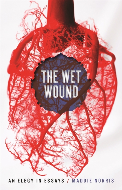 The Wet Wound : An Elegy in Essays, EPUB eBook