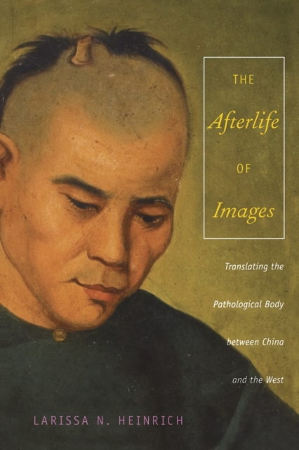 The Afterlife of Images : Translating the Pathological Body between China and the West, Paperback / softback Book