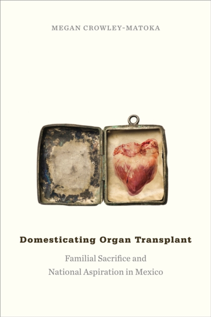 Domesticating Organ Transplant : Familial Sacrifice and National Aspiration in Mexico, Paperback / softback Book